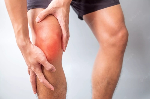 Artrosis De Rodilla: Causas, Síntomas Y Tratamientos