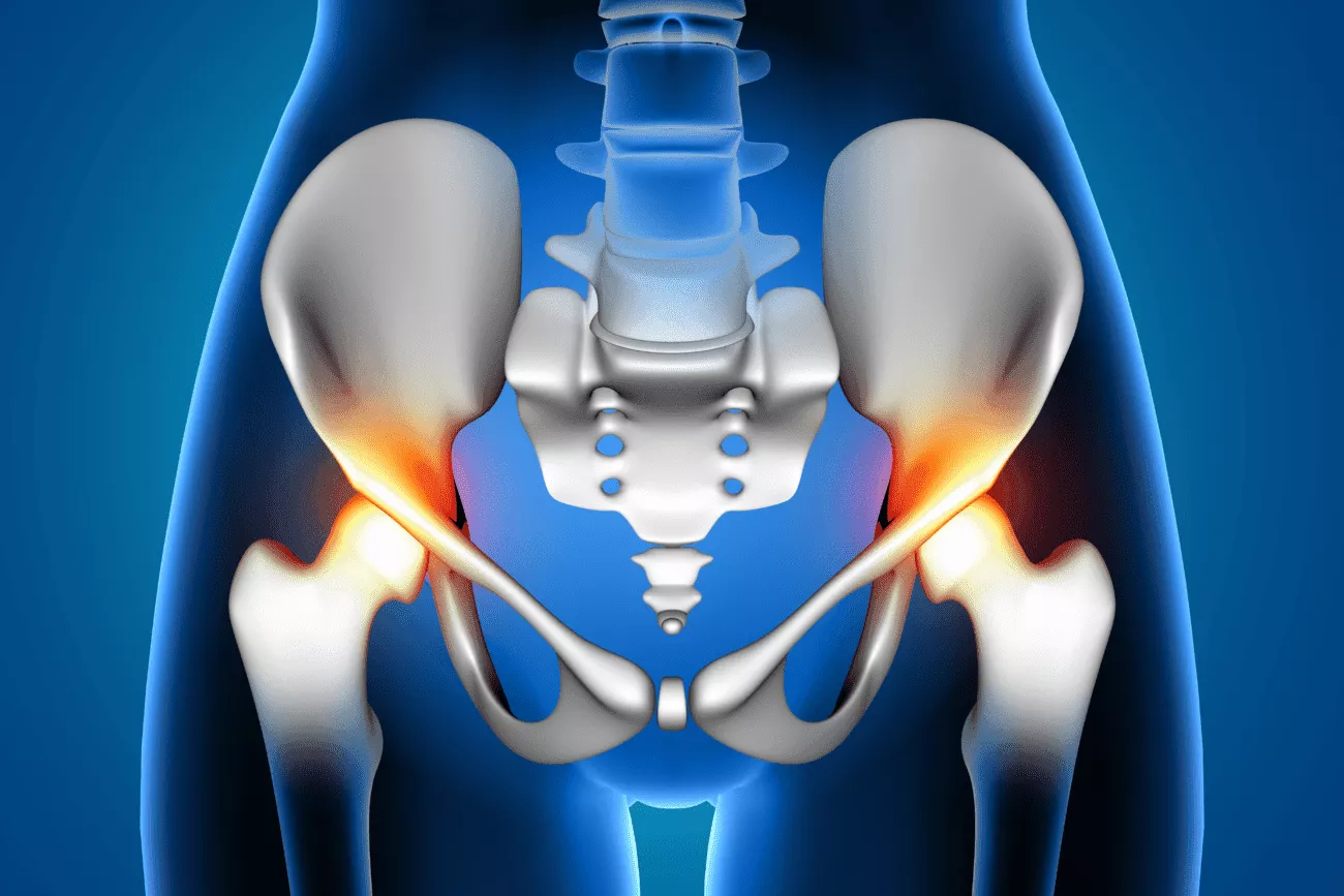 Artrosis de Rodilla: Causas, Síntomas y Tratamientos - Incar - Clínica Osten