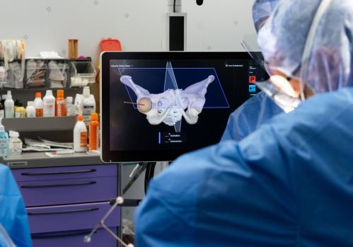 Cirujano utilizando tecnología robótica CORI durante una intervención de cadera con visualización 3D en tiempo real, mejorando la precisión quirúrgica.